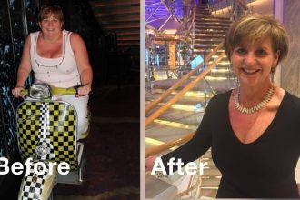 From Patient to Pioneer: How a Bariatric Surgery Nurse is Inspiring Change