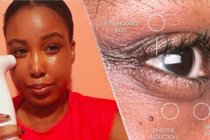 90 Days with NIRA Pro: See My Stunning Anti-Wrinkle Transformation!