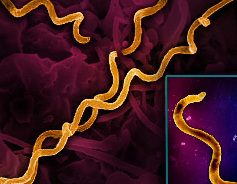 Revolutionizing Syphilis Detection: NIH Awards Propel Cutting-Edge Diagnostic Innovations