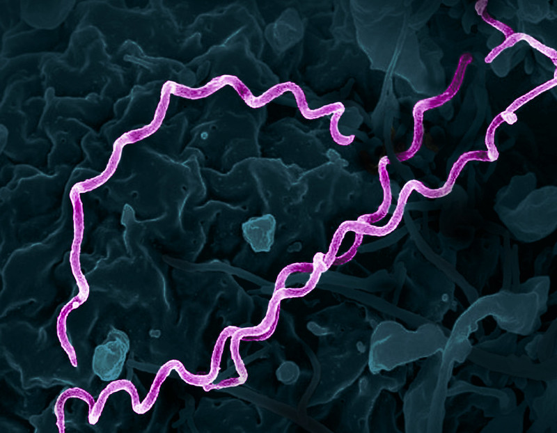 Revolutionary Emergency Department Screening Doubles Syphilis Detection Rates!